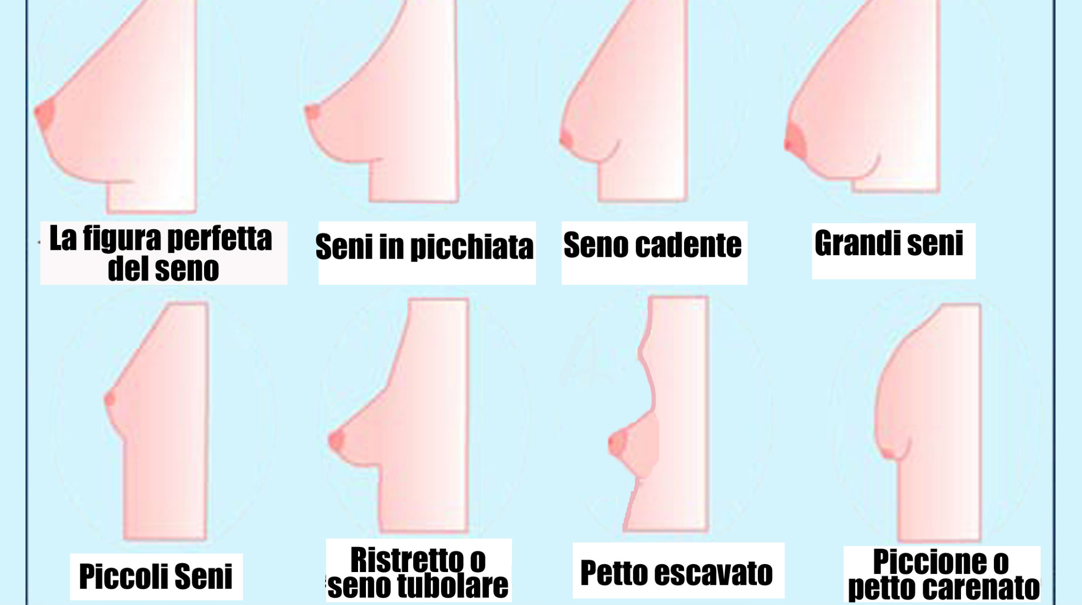 Strada moderna di aumento di un petto