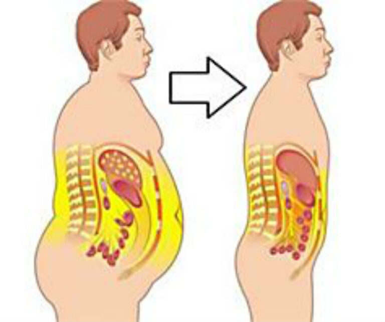 Snaketrap Fat Pills